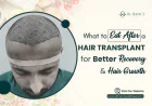What to Eat After a Hair Transplant for Better Recovery & Hair Growth