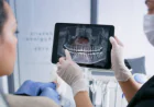 Dental Tooth Filling: What Patients Should Know