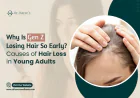Why Is Gen Z Losing Hair So Early? Causes of Hair Loss in Young Adults
