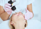 What Can CO2 Laser Treat on Your Skin?