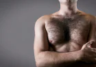 How Does a Body Hair Transplant Restore Scalp Hair?