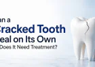 Can a Cracked Tooth Heal on Its Own or Does It Need Treatment?