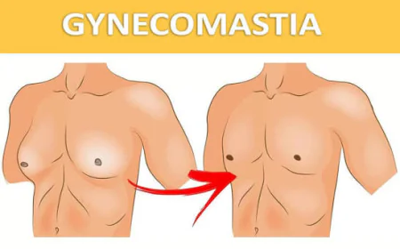 Understanding What Influences Gynecomastia Surgery Pricing