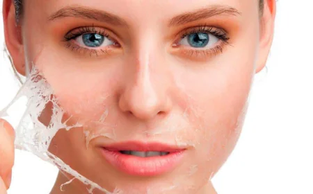 Why Is Chemical Peel Treatment Popular?