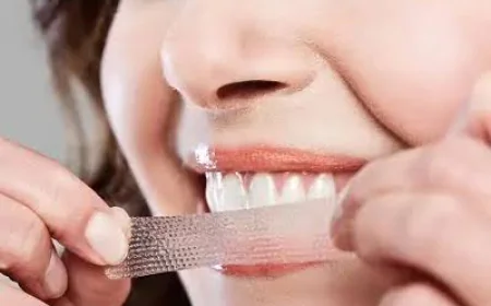 How Zoom Teeth Whitening in Dubai Helps Restore a Brighter Smile Naturally