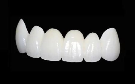 Zirconia Crowns in Dubai for Long-Lasting Smile Restoration