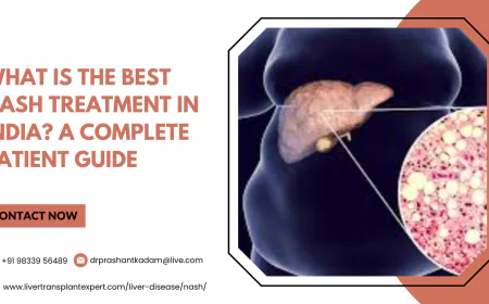 What Is the Best NASH Treatment in India? A Complete Patient Guide