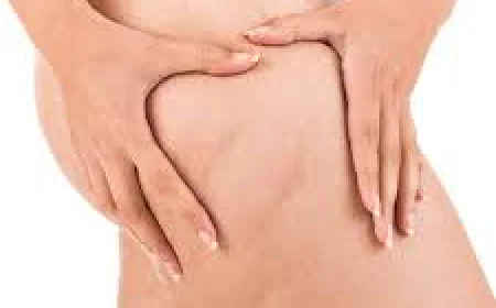 Cellulite Treatment in Dubai for Smoother and Firmer Looking Skin