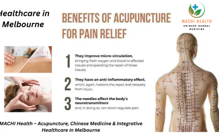 Acupuncture Melbourne | Cost, Benefits, Medicare & Best Clinics Guide (2026)