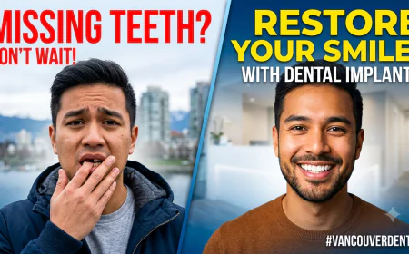Why a Dental Implant Vancouver Solution Is the Gold Standard for Missing Teeth