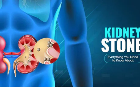 Numerous Benefits Of Laser Treatment For Kidney Stones