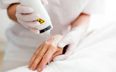 How Much Downtime Does Laser Skin Resurfacing San Jose Need?