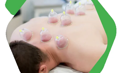Cosmetic Acupuncture Calgary Treatments for Glowing and Healthy Skin