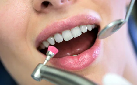 Teeth Cleaning in Dubai: Benefits You Should Know