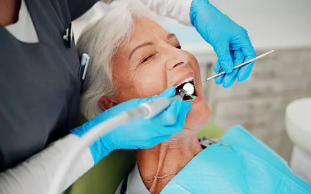 Teeth Cleaning in Dubai: What to Expect