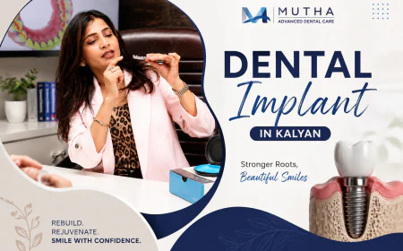Are Dental Implants a Good Option for Replacing Missing Teeth?