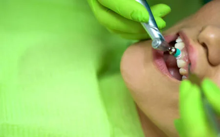 Teeth Polishing & Scaling in Dubai: What to Expect