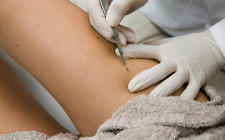 Can Skin Tag Removal Treatment Remove Multiple Skin Tags