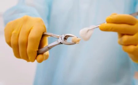 Tooth Extraction: What to Know Before, During and After Treatment