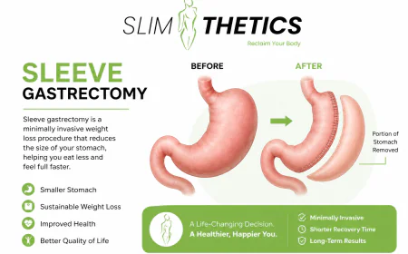 Sleeve Gastrectomy vs Gastric Balloon: Which Weight Loss Option Is Right?