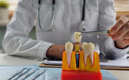 What Should You Know Before Choosing an Implant After Tooth Loss?