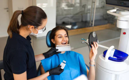 Dental Veneers: Complete Guide to a Better Smile