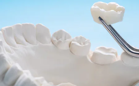 Transform Your Smile with Custom Durable Dental Crowns and Procedure