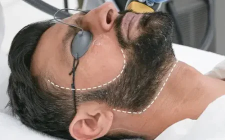 Does Beard Laser Hair Removal Work on Thick Beards?