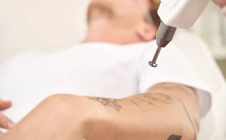 Can Laser Tattoo Removal Help Remove Tattoo Regret?
