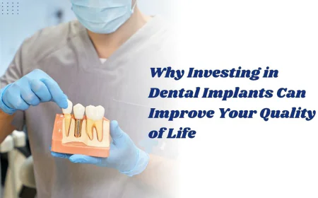 Why Investing in Dental Implants Can Improve Your Quality of Life