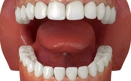 Dental Implants: How Long Can They Last?
