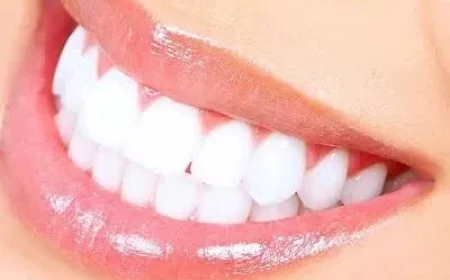 Effective Teeth Whitening Solutions in Dubai & Abu Dhabi | Glamorous Clinic Dubai