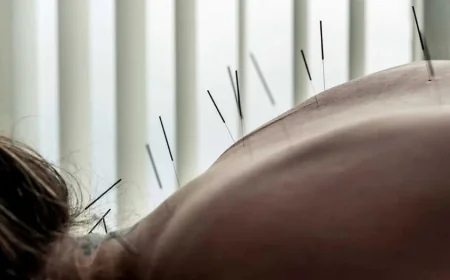 What Acupuncture Can Actually Help With: An Honest Guide