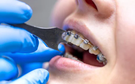 Affordable Braces and Same-Day Dental Implants in Houston