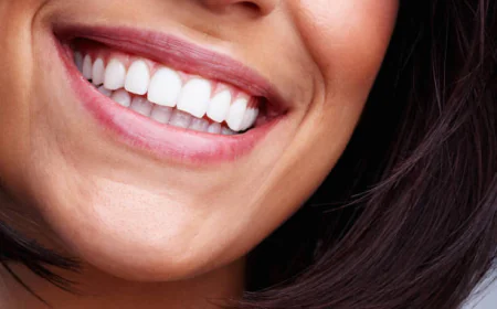 Can Teeth Whitening help brighten a stained smile