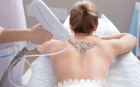What Makes Laser Tattoo Removal Work So Well?