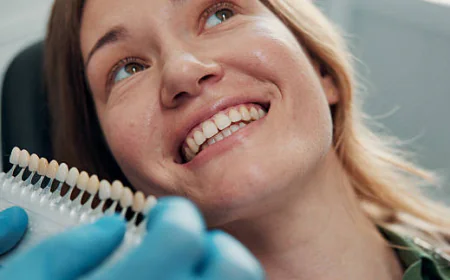 Dental Veneers: Benefits, Types and What to Expect