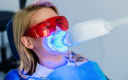 Teeth Whitening: Benefits, Options and What to Expect