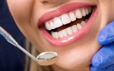 E-Max Veneers in Dubai & Abu Dhabi with Precision Smile Design | Glamorous Clinic Dubai