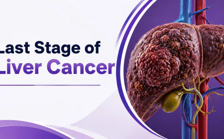 What Is the Last Stage of Liver Cancer?
