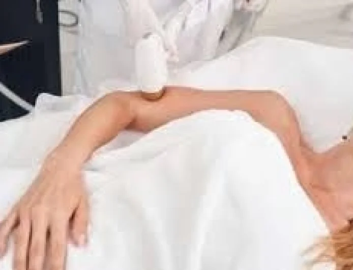 Is Laser Hair Removal Effective in Women With PCOS