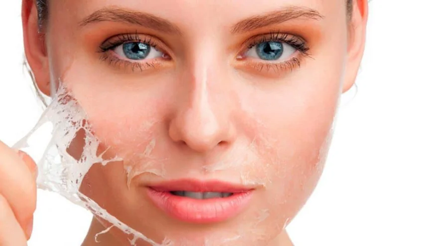 Why Is Chemical Peel Treatment Popular?