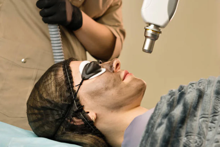 Does Laser Carbon Peeling Tighten the Skin?