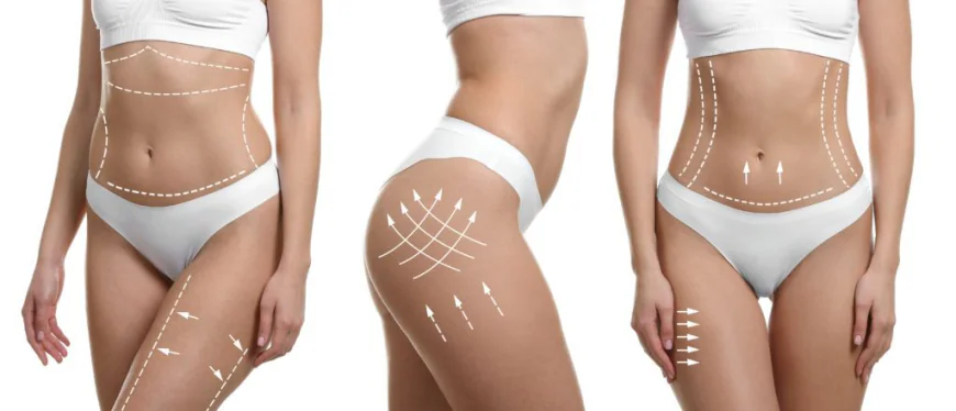 Body Contouring in Islamabad: How Proportion Creates the Perfect Visual Balance