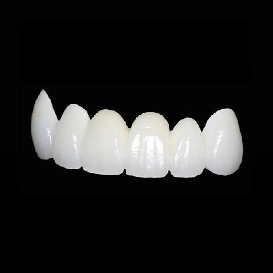 Zirconia Crowns in Dubai for Long-Lasting Smile Restoration