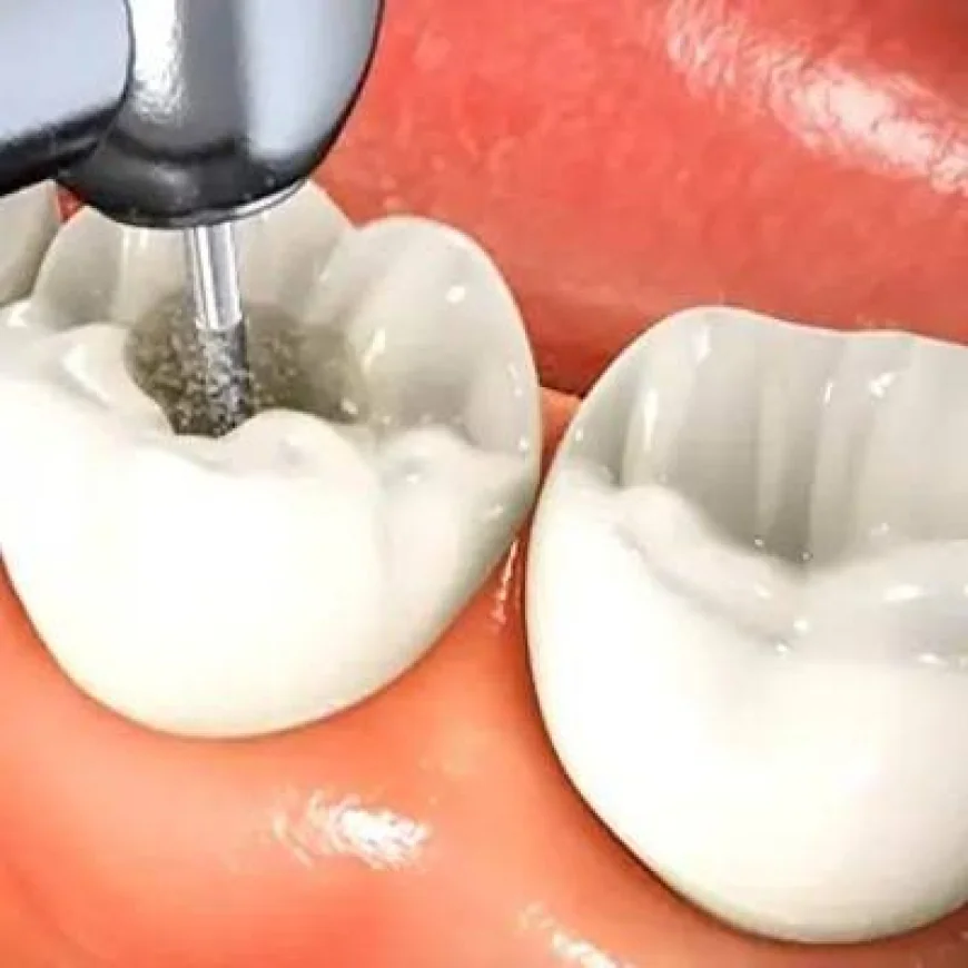 Root Canal Treatment in Dubai: Restore Your Dental Health with Advanced Care