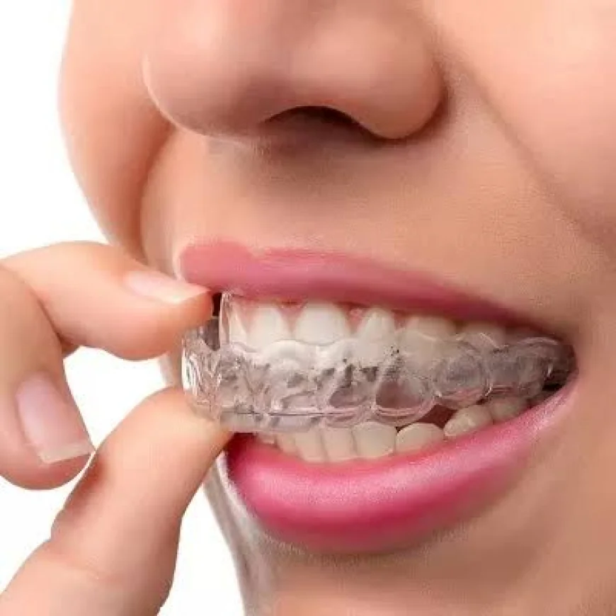 Sports Dental Guards in Dubai for Complete Protection During Sports Activities