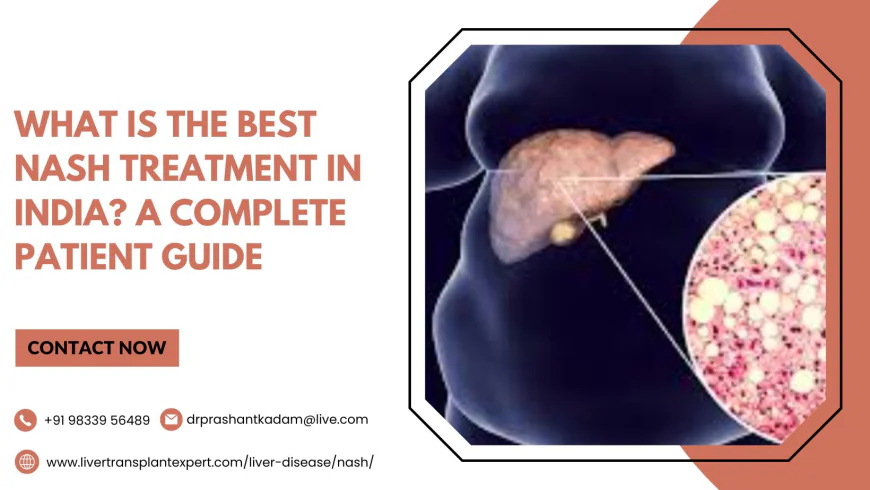 What Is the Best NASH Treatment in India? A Complete Patient Guide