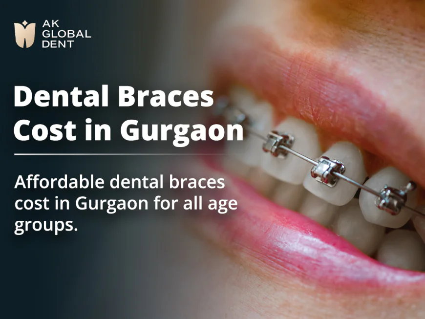 Best Orthodontist in Gurgaon: A Complete Guide to Dental Braces Cost in Gurgaon