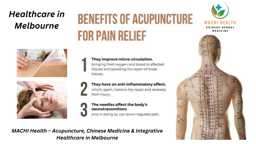 Acupuncture Melbourne | Cost, Benefits, Medicare & Best Clinics Guide (2026)